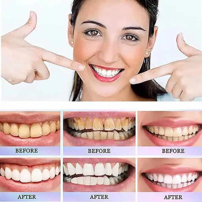 Oralhoe - Nicotinamide Dazzle White Toothpaste (Original)